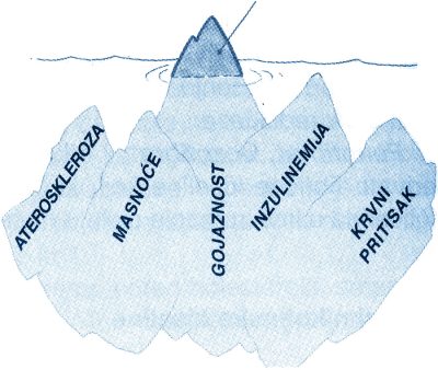Šećerna je bolest je samo vrh ledene gromade metaboličkog sindroma